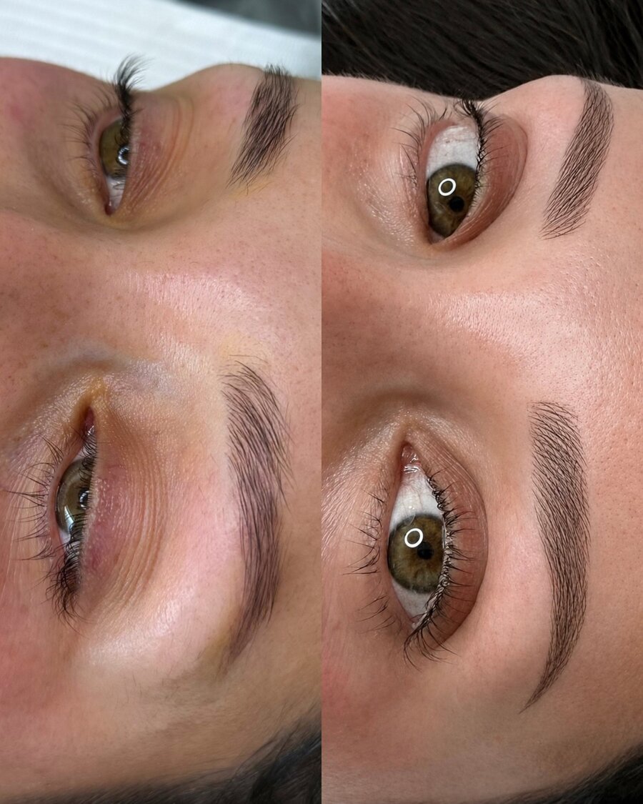 Microshading Before & After — Eye Closeup
